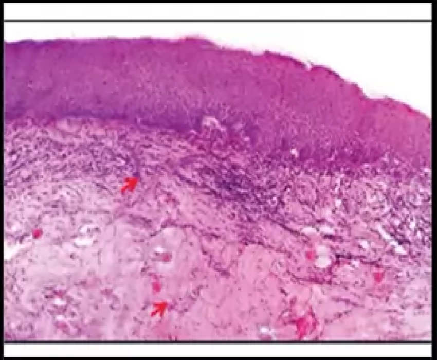 saraswati dental college