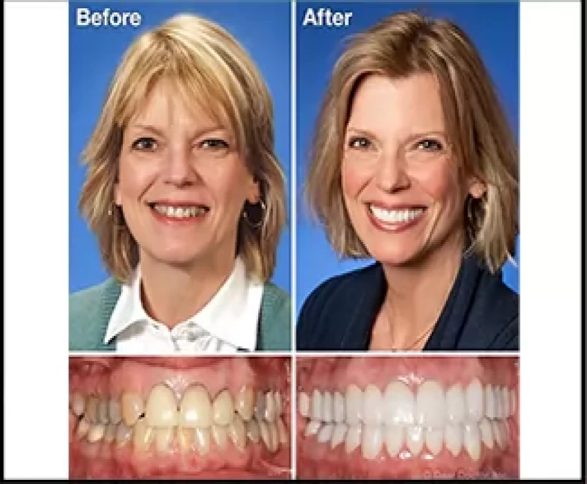 saraswati dental college