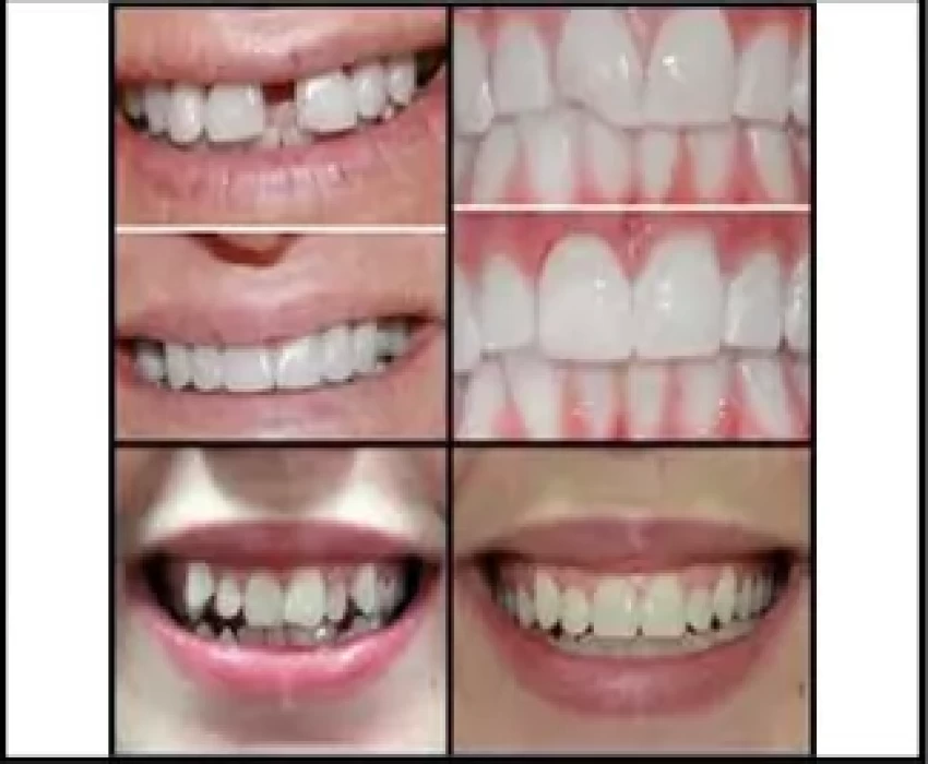 saraswati dental college