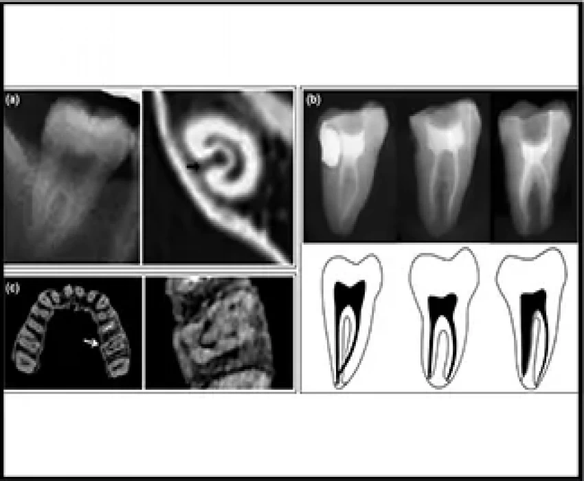 saraswati dental college