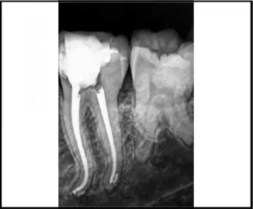 saraswati dental college