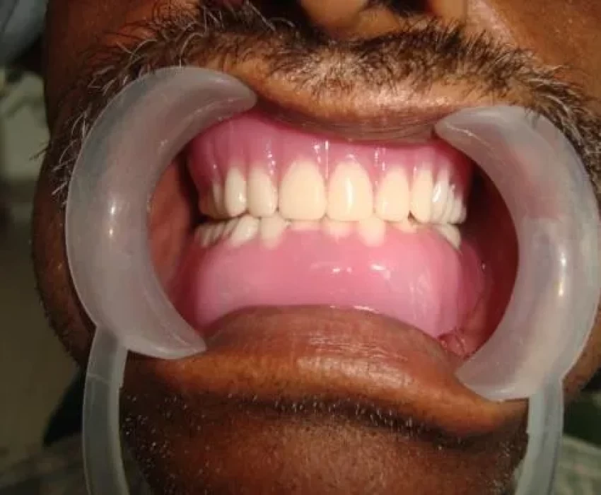 saraswati dental college