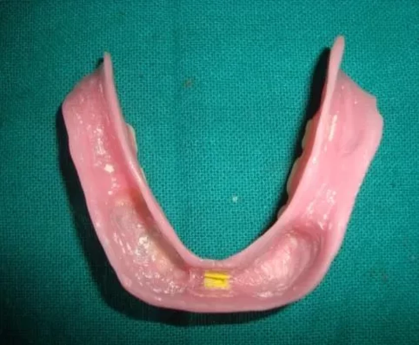 saraswati dental college