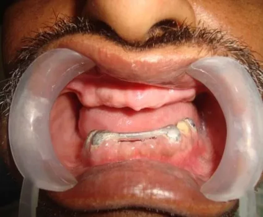 saraswati dental college