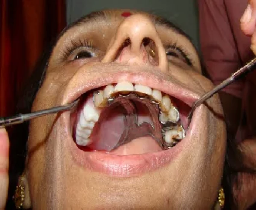 saraswati dental college