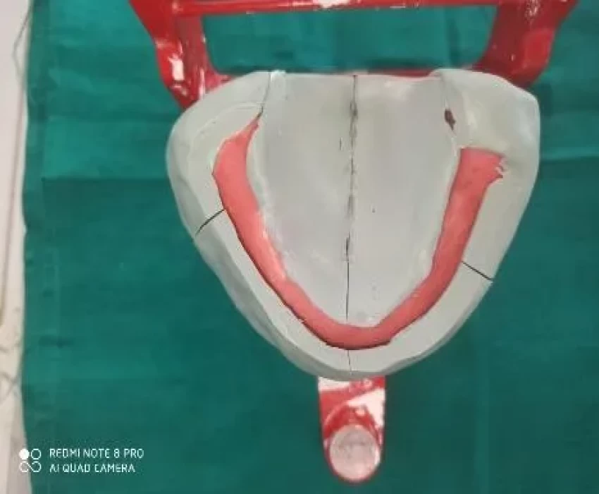 saraswati dental college