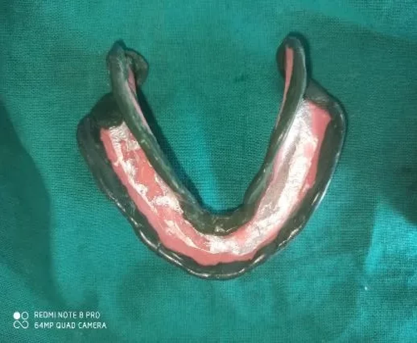 saraswati dental college