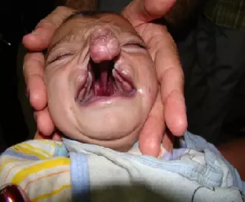 saraswati dental college