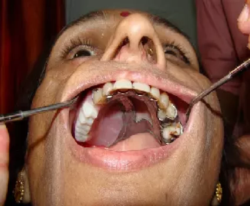 saraswati dental college