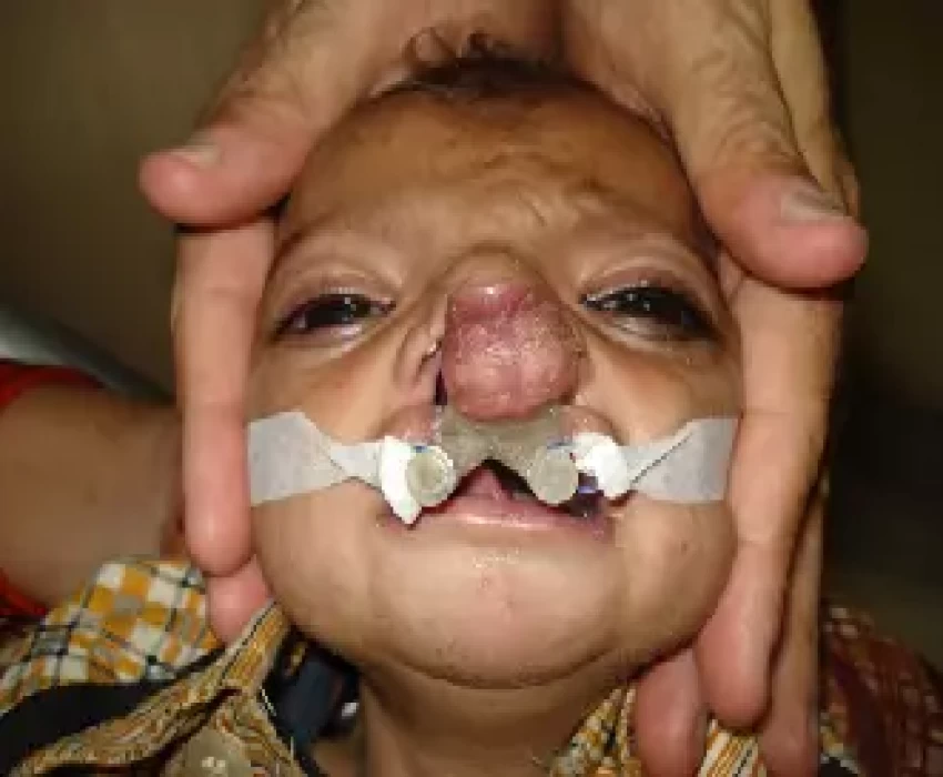 saraswati dental college