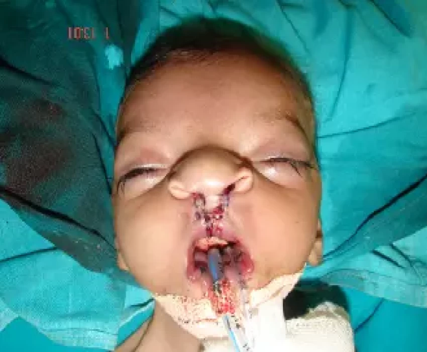 saraswati dental college