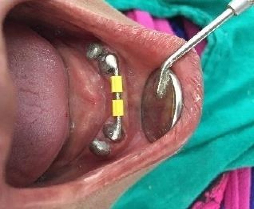 saraswati dental college