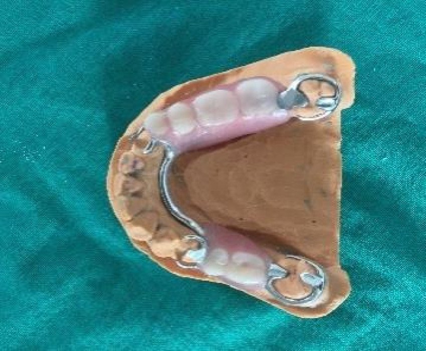 saraswati dental college