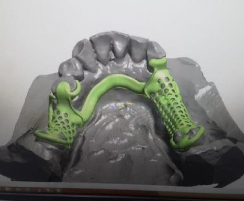 saraswati dental college