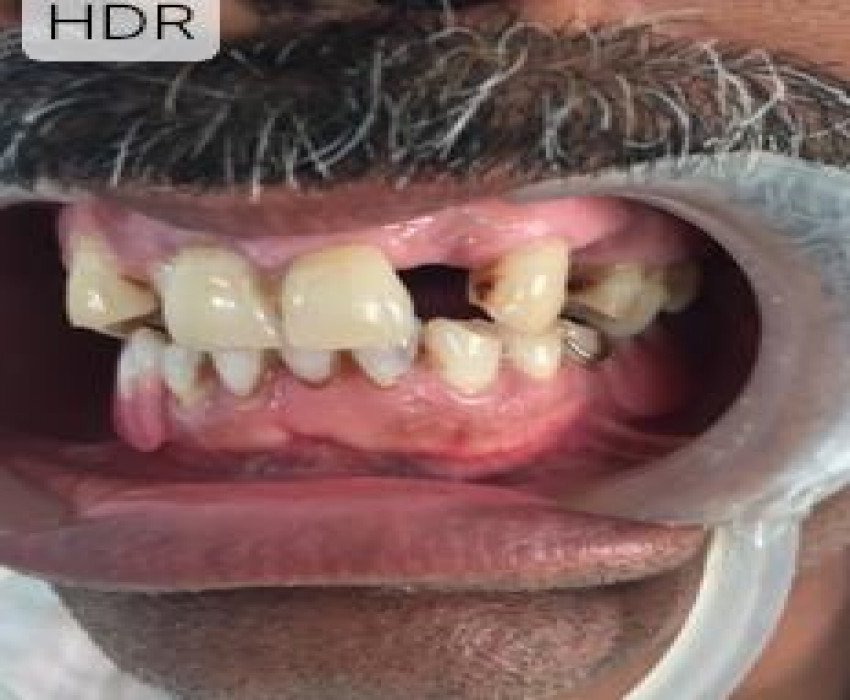 saraswati dental college