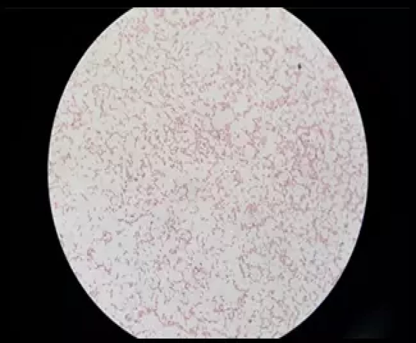 saraswati dental college