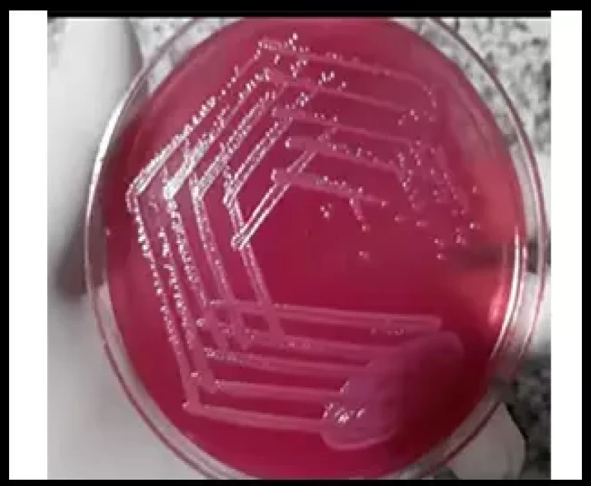 saraswati dental college