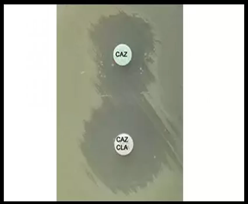 saraswati dental college