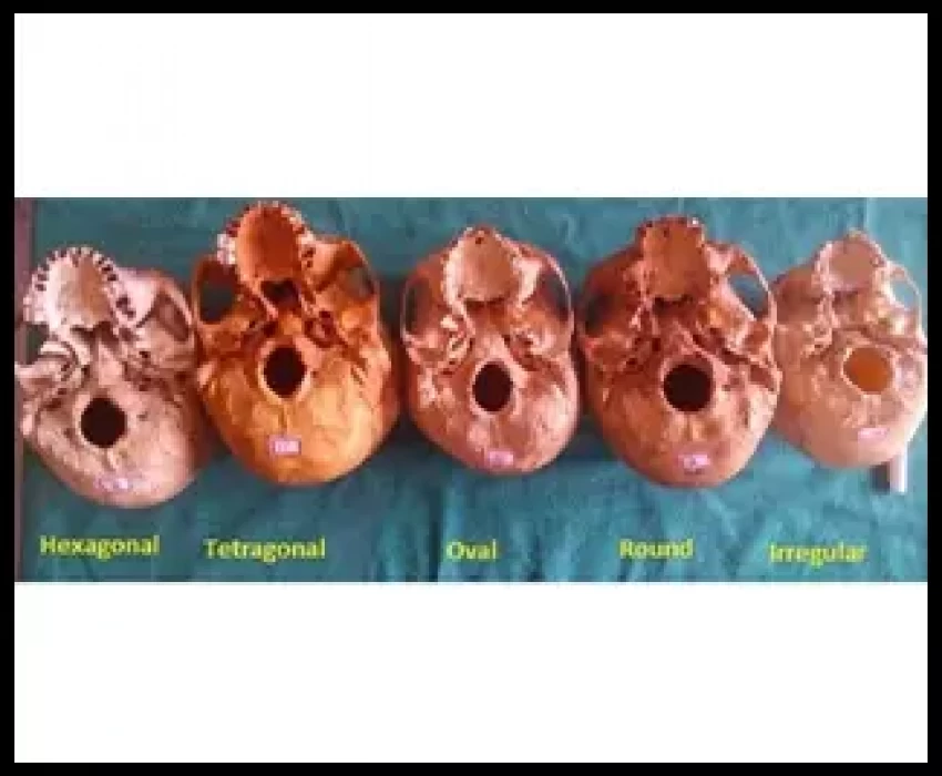 saraswati dental college