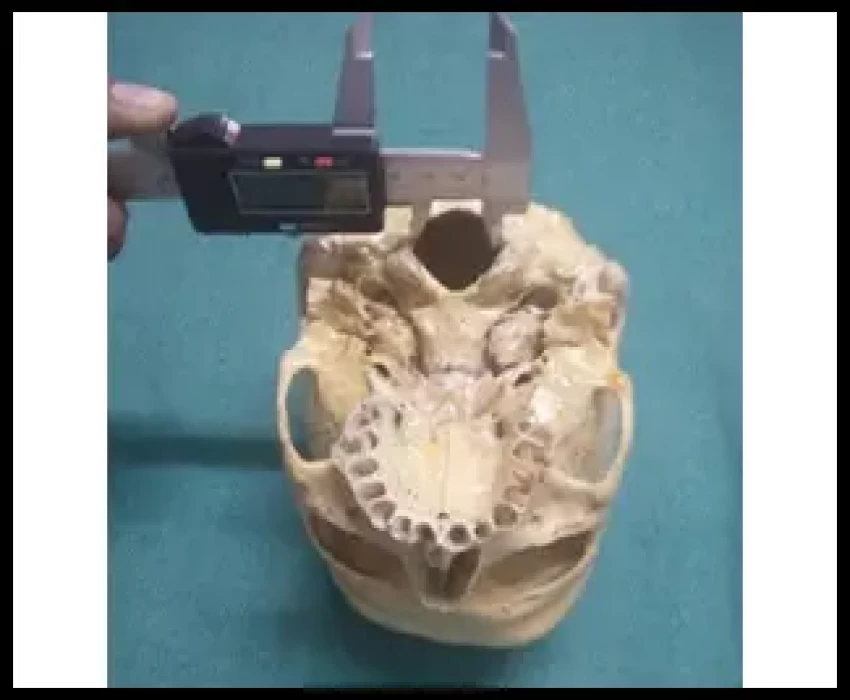 saraswati dental college