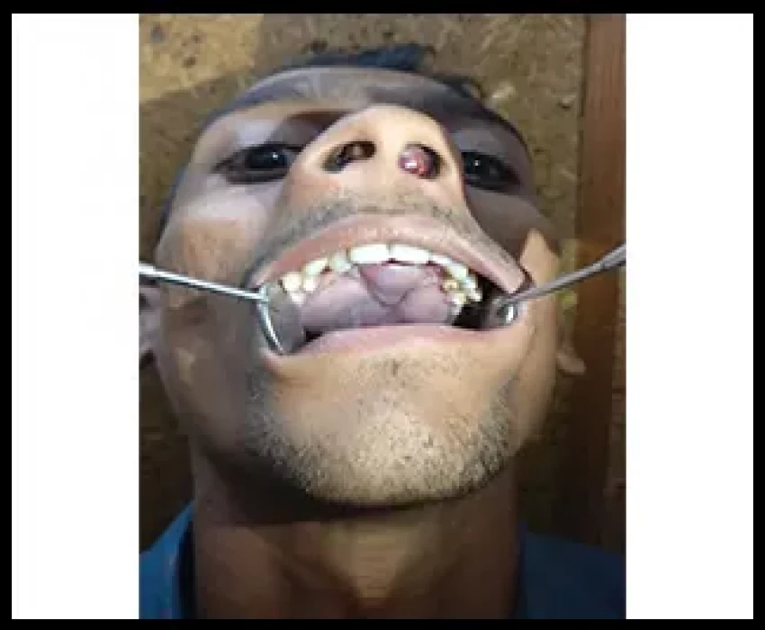 saraswati dental college