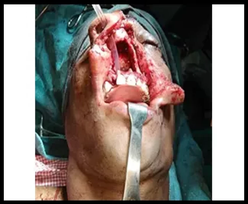 saraswati dental college