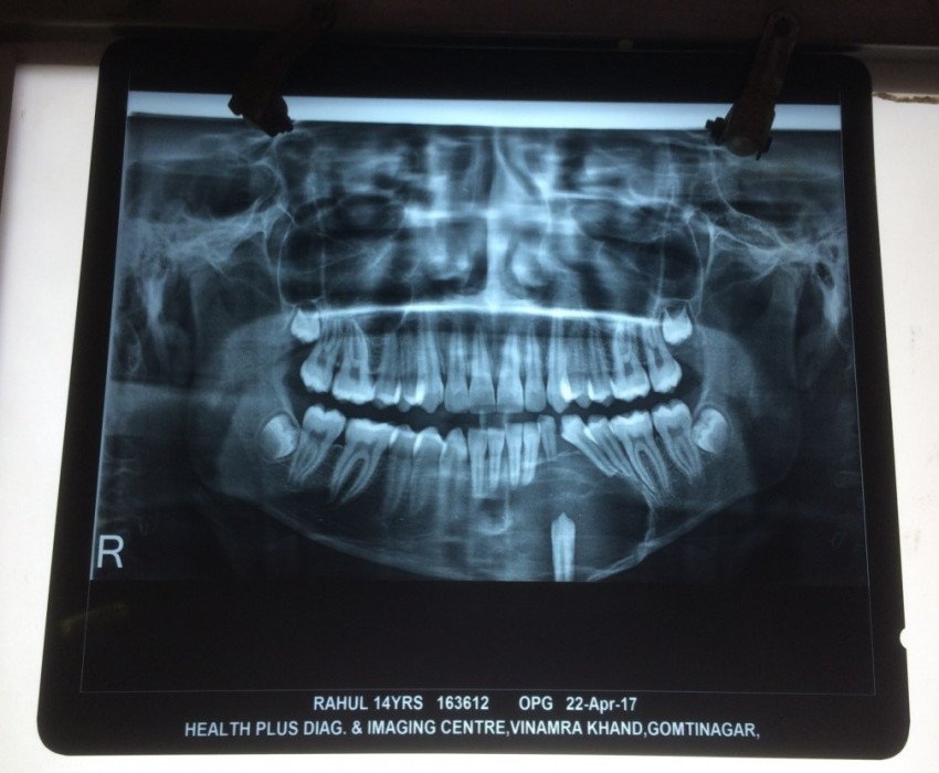 saraswati dental college