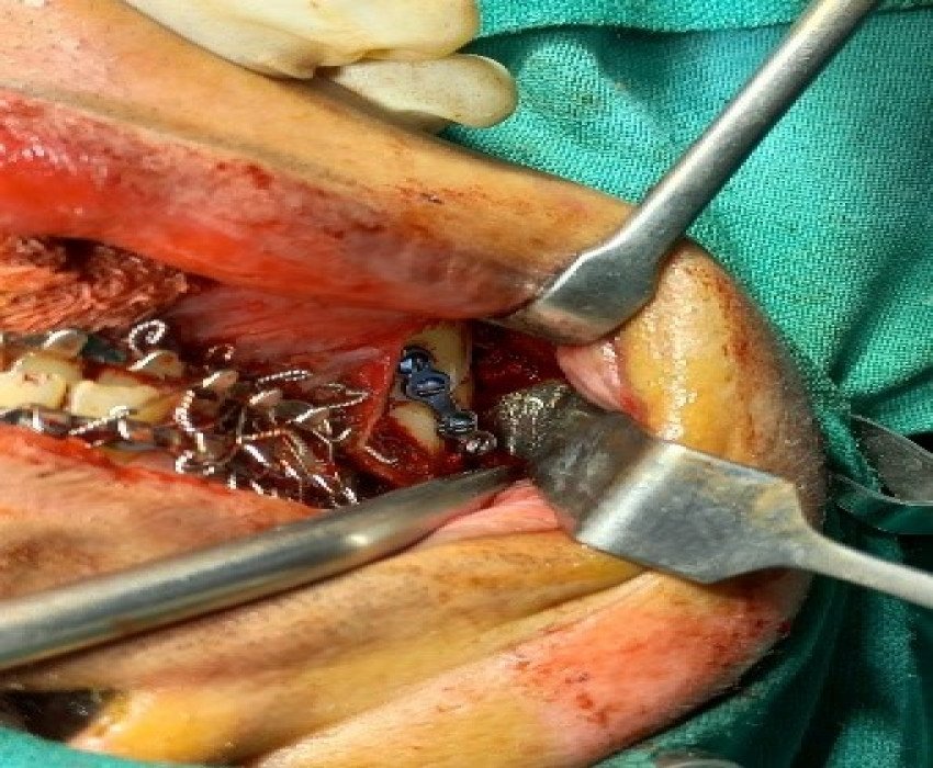 saraswati dental college