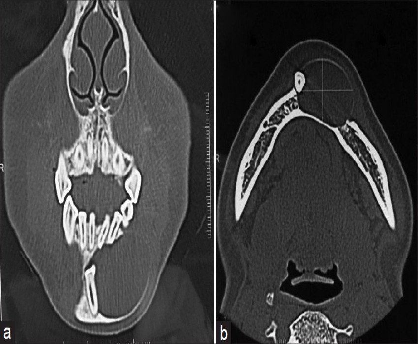saraswati dental college