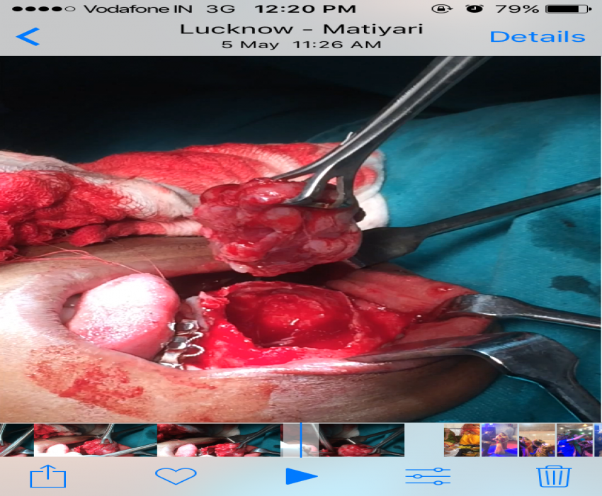 saraswati dental college