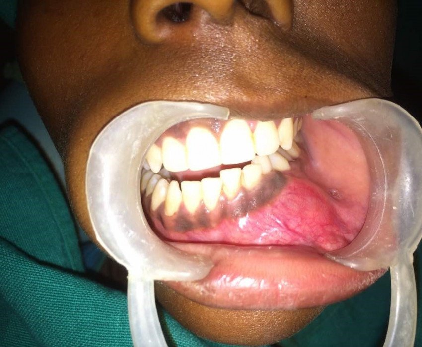 saraswati dental college