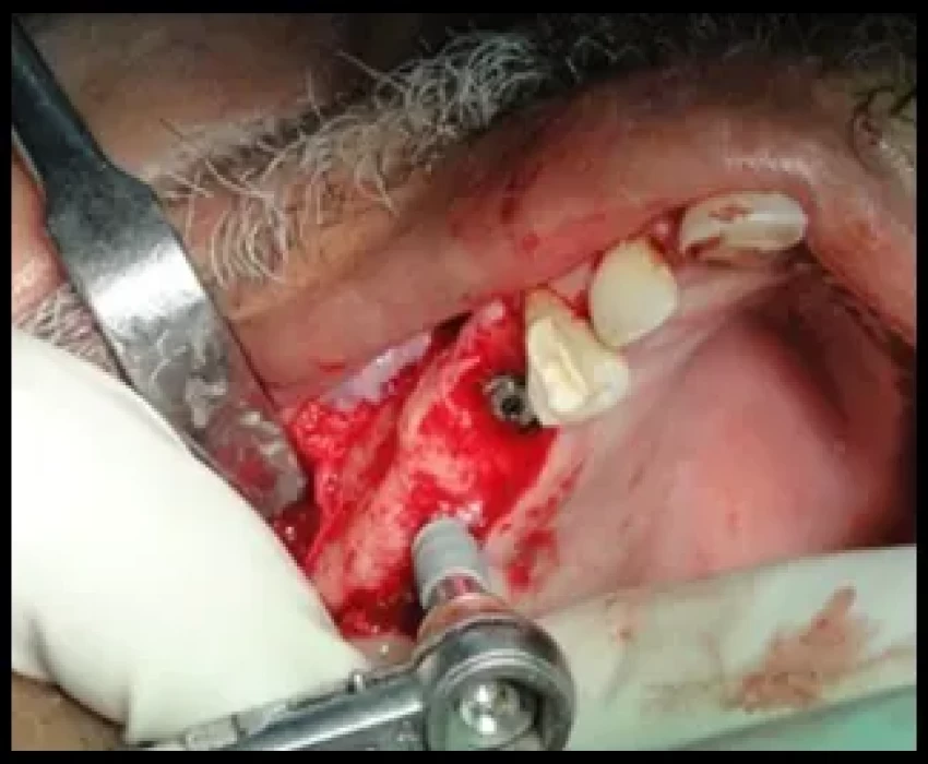 saraswati dental college