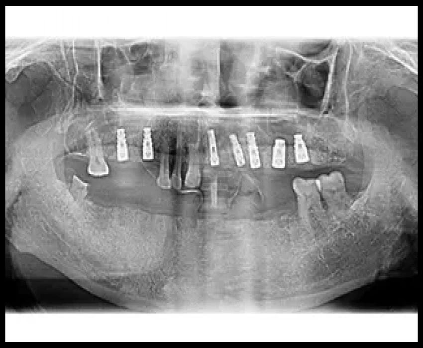 saraswati dental college