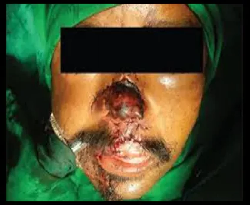 saraswati dental college