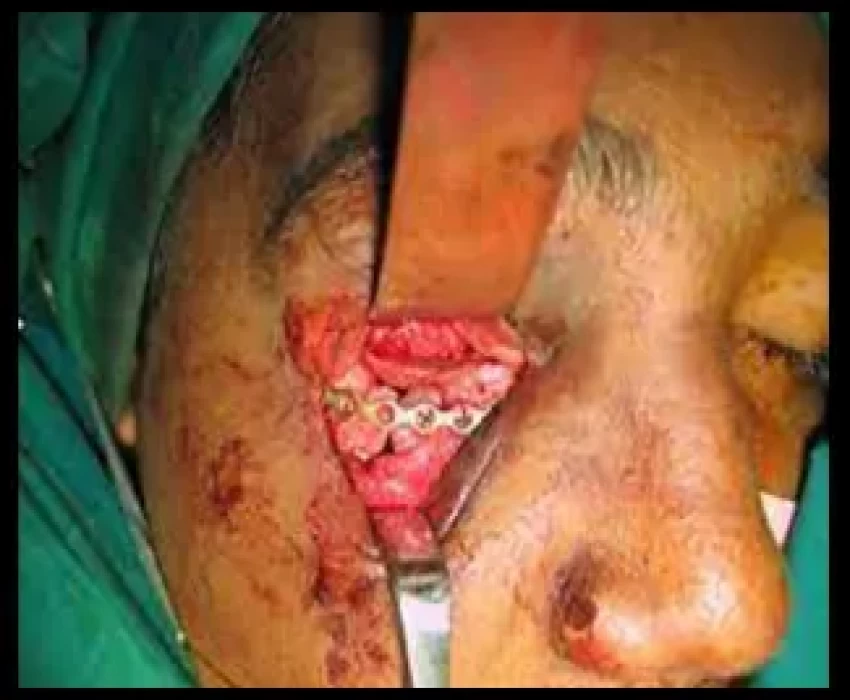 saraswati dental college