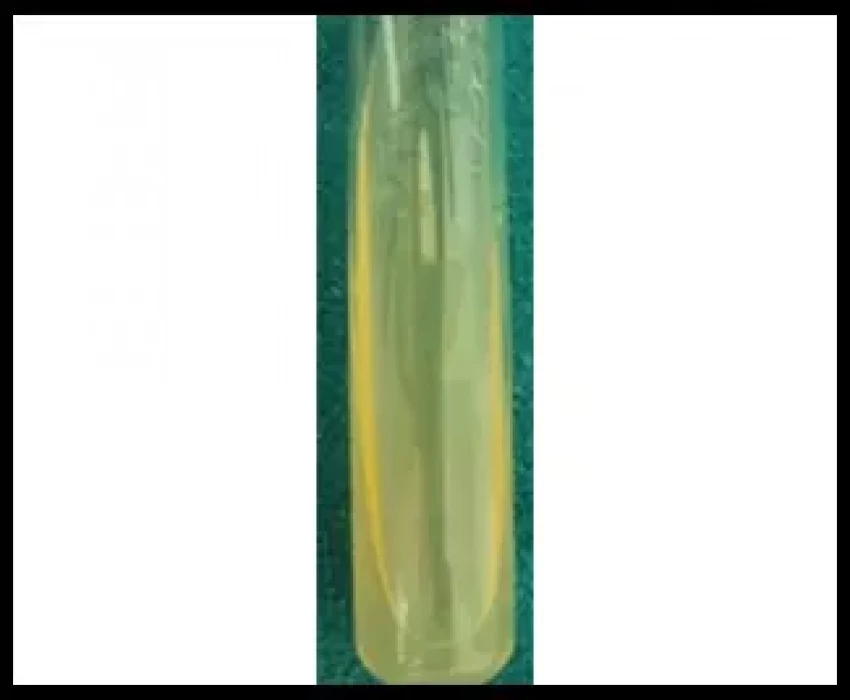 saraswati dental college