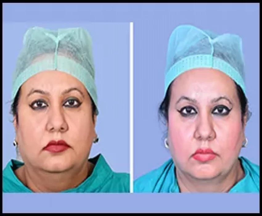 saraswati dental college