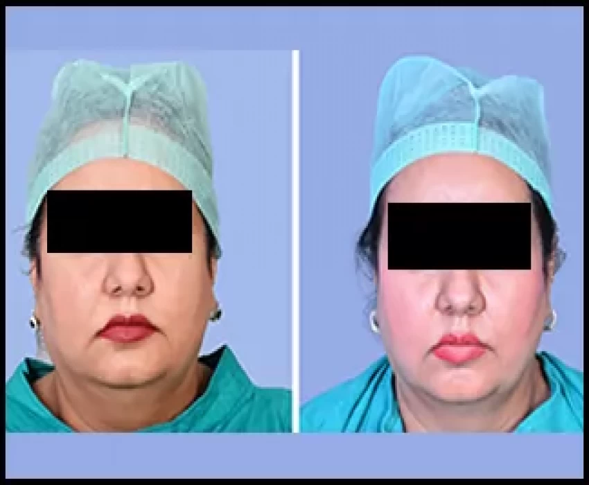 saraswati dental college