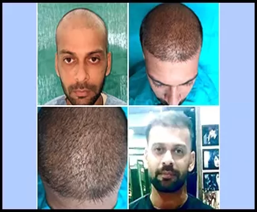 saraswati dental college