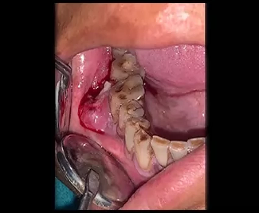 saraswati dental college