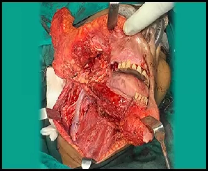 saraswati dental college