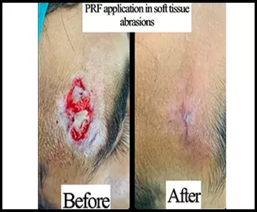 saraswati dental college