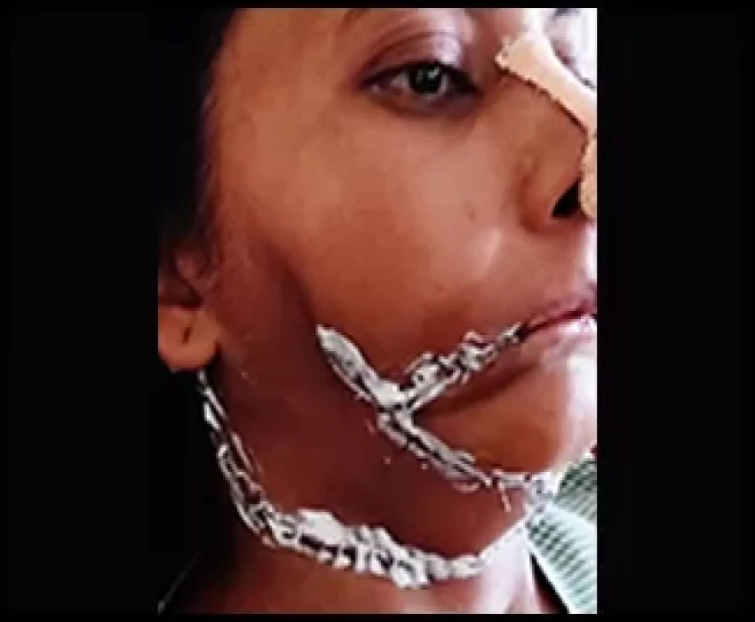 saraswati dental college