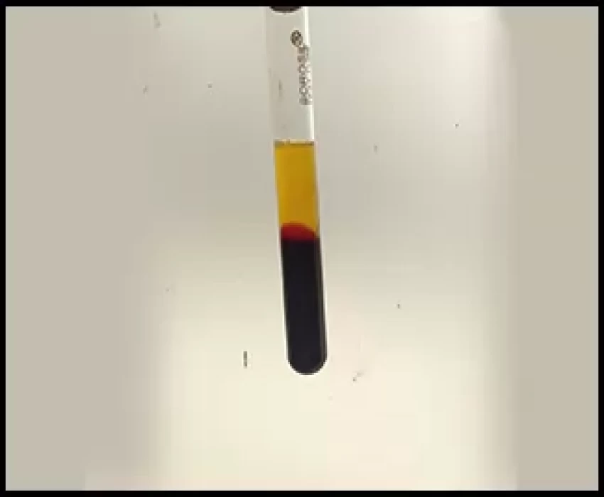 saraswati dental college