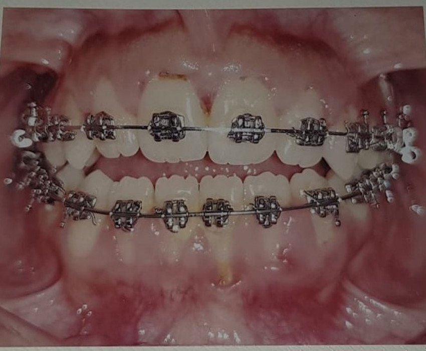 saraswati dental college