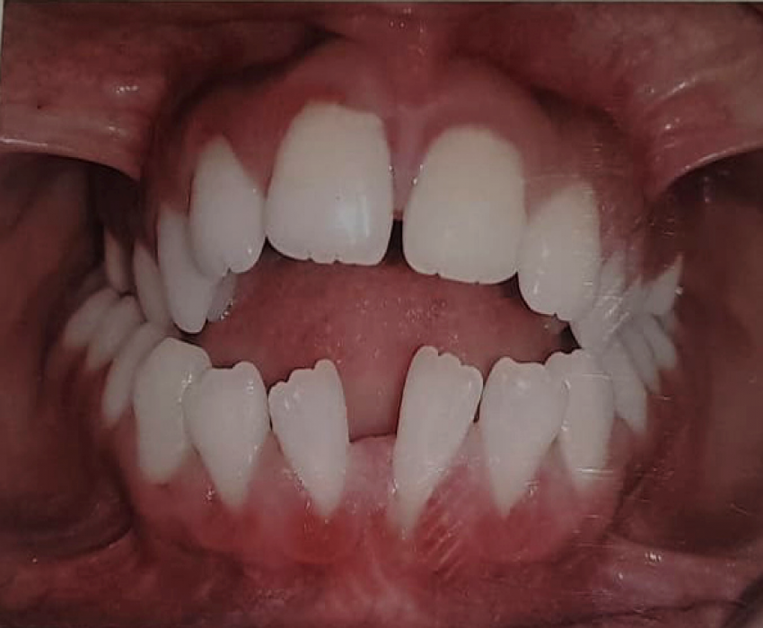 saraswati dental college