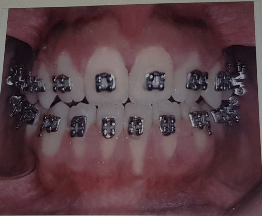 saraswati dental college