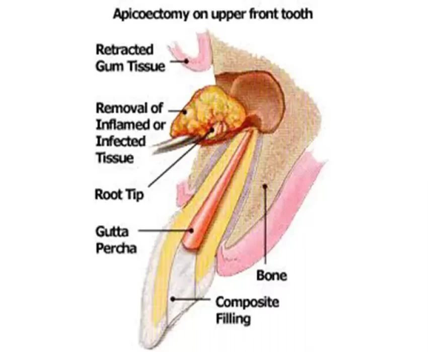 saraswati dental college