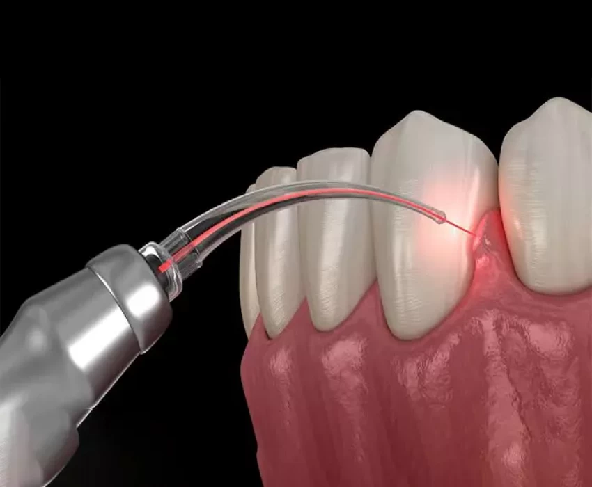 saraswati dental college