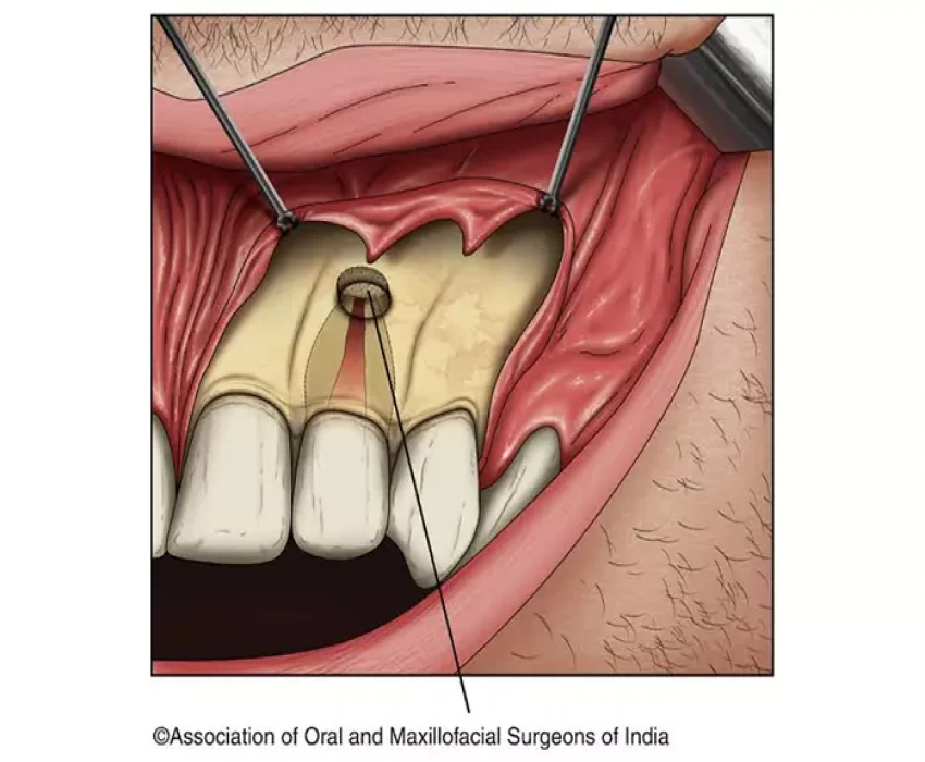 saraswati dental college